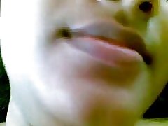 Malu sekretorius nusirengimas